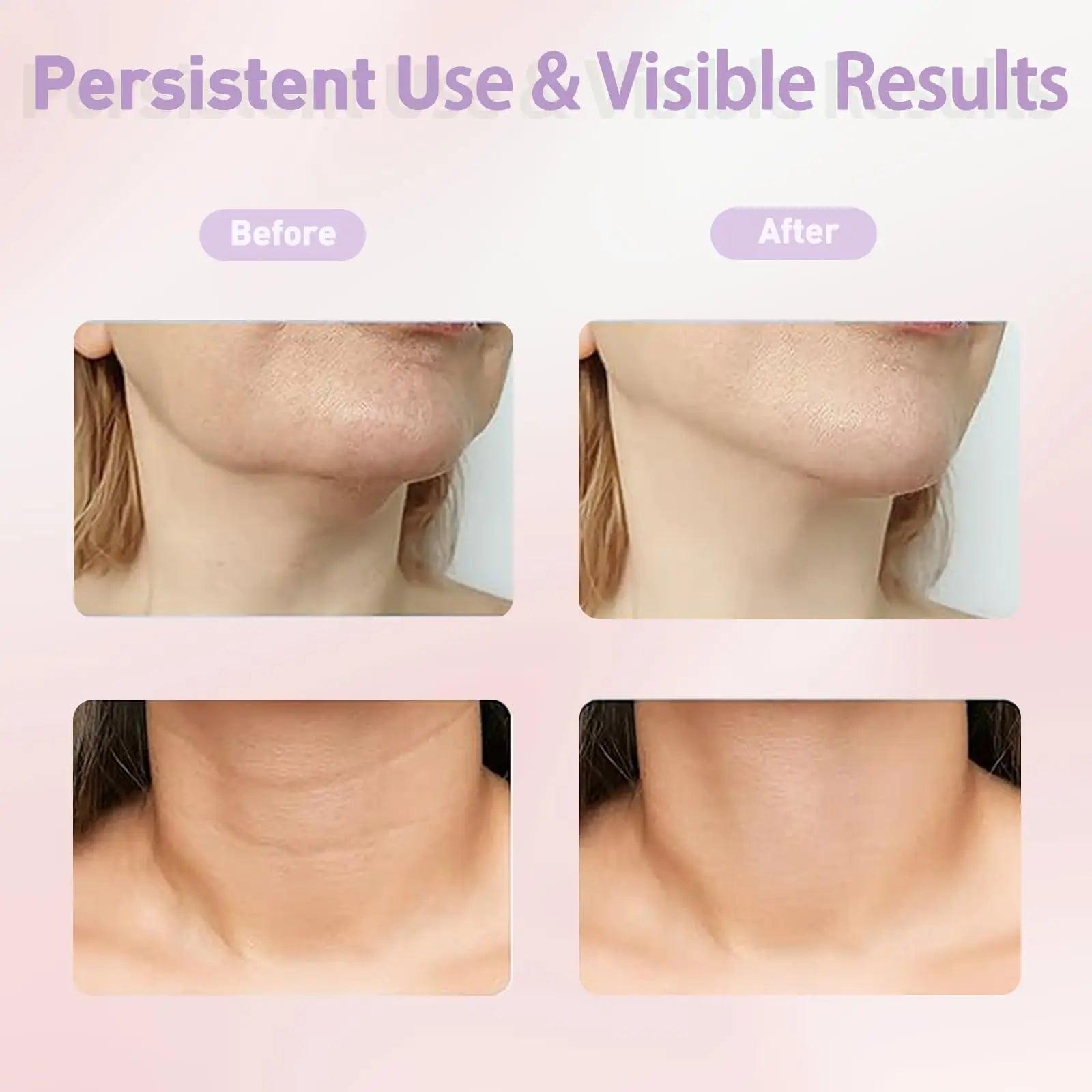 Delmea ™ RadianceLift Face & Neck Massager